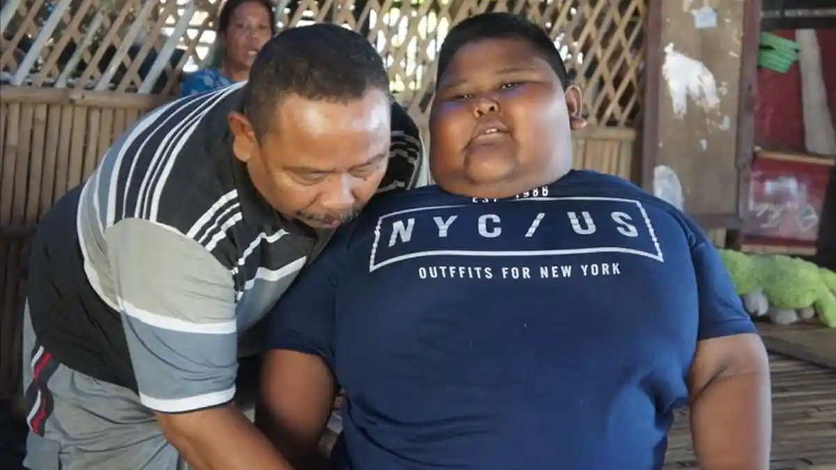Bocah Berat 110 Kg Meninggal Kesakitan