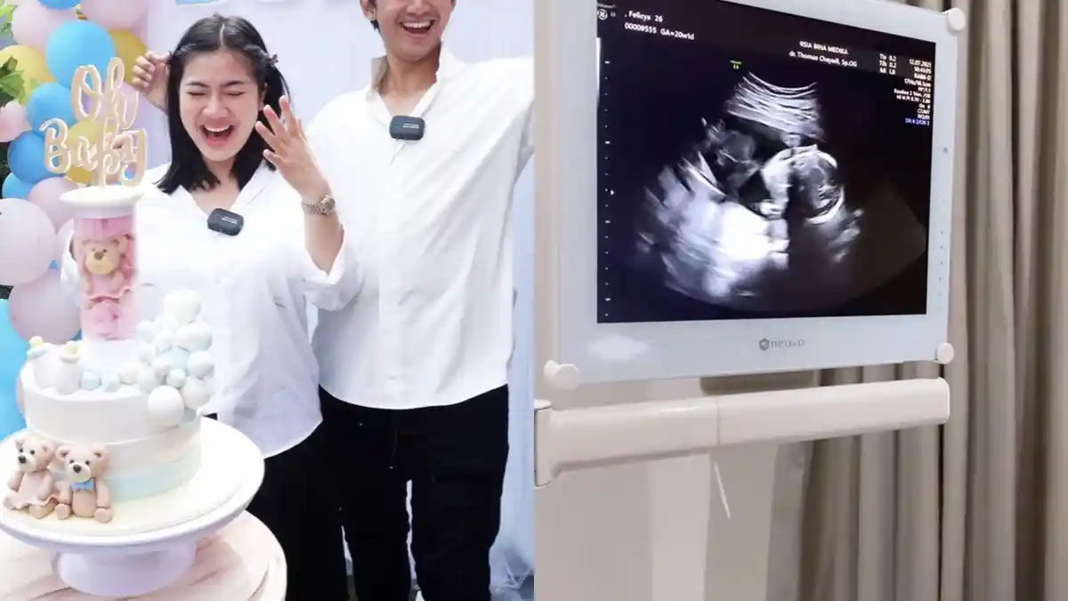 Felicya Angelista Alami Pendarahan, Kondisi Janin Terungkap