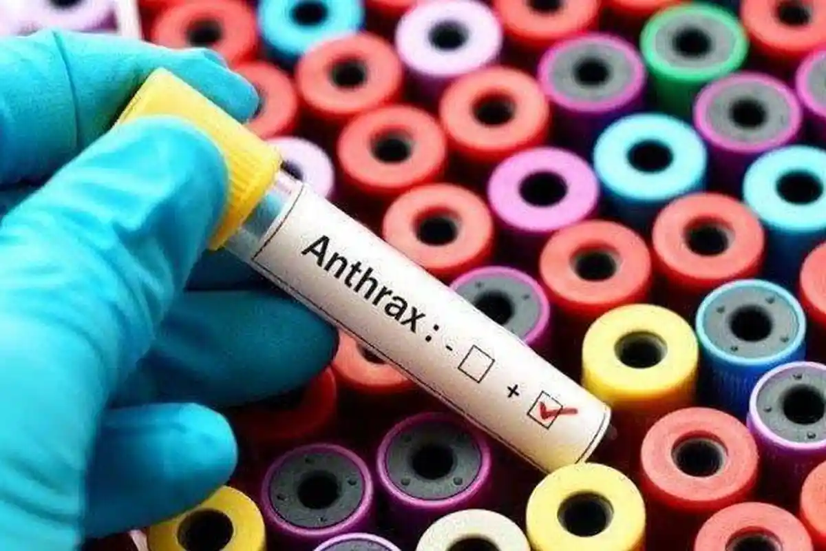 Heboh di Gorontalo, Apakah Penyakit Antraks Bisa Menular Antarmanusia? Ini Penjelasannya