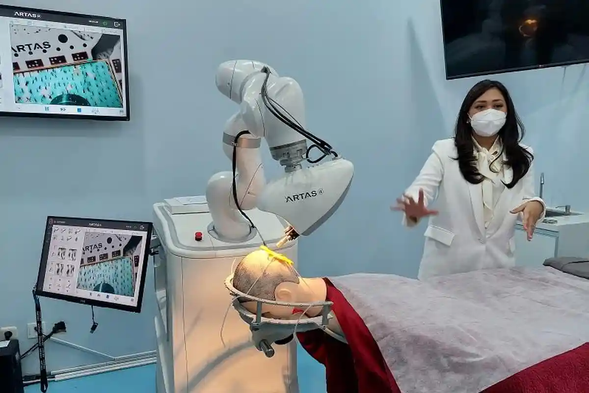 Hadir Pertama di Asia Pasific dan Indonesia, Robot Tanam Rambut Solusi Atasi Kebotakan