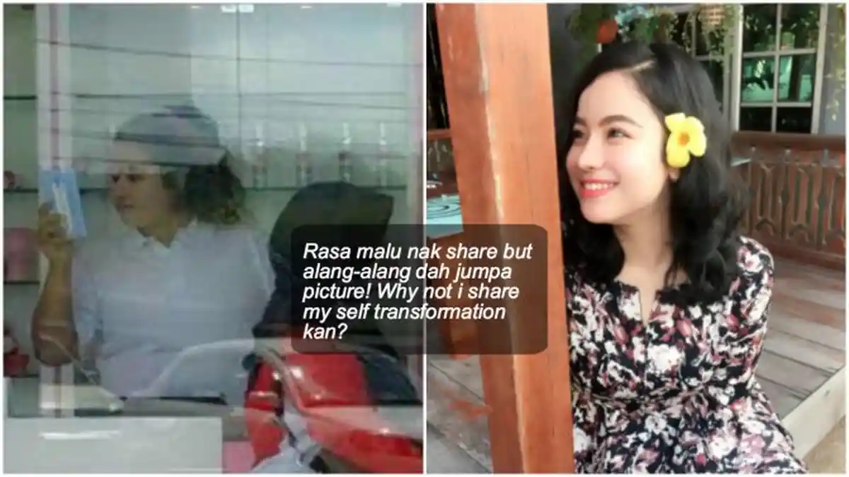 Wow Hanya dengan Lakukan Lima Cara Sederhana, Gadis Ini Sukses Turunkan Berat Badan
