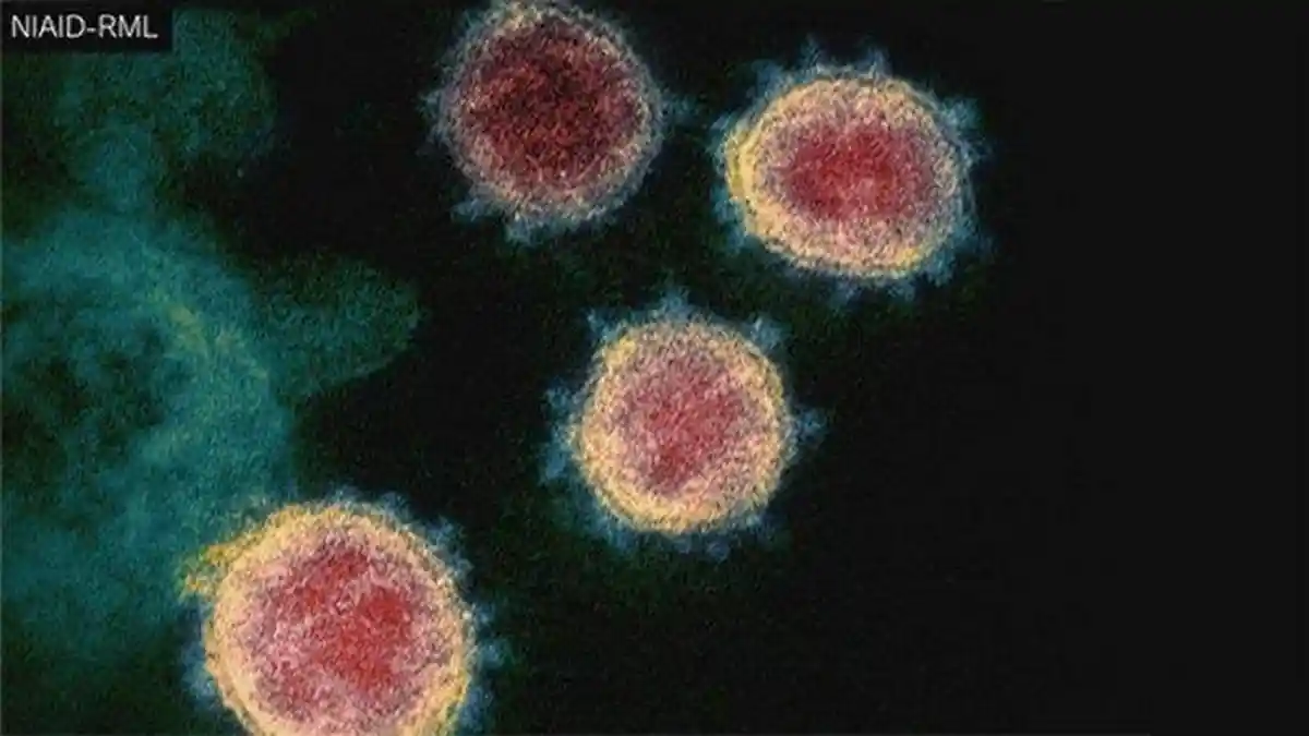 Ancaman Belum Berakhir, Virus Nipah Berpotensi Jadi Pandemi Baru