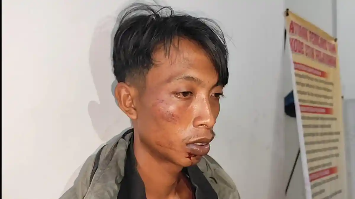 Warga Asahan Mengaku Diculik hingga Dianiaya dari Lokasi Perkebunan