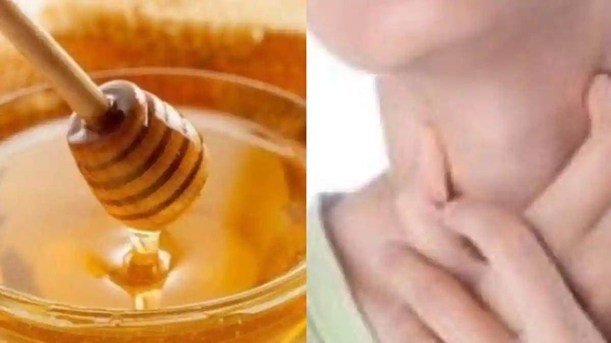 Simak Kandungan dan Manfaat Madu yang Efektif sebagai Obat Sakit ...