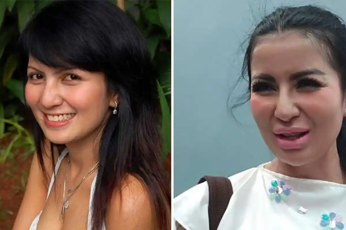 Masih Ingat Si Seksi Five Vi? Kini Banyak Netizen yang Kecewa dengan Wajahnya, Coba Lihat Bibirnya