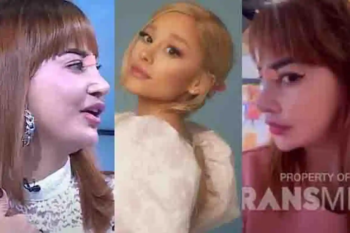 Nasib Artis Dangdut Oplas Mancung Mirip Ariana Grande Hidungnya Malah Miring, Gagal Blasteran Eropa