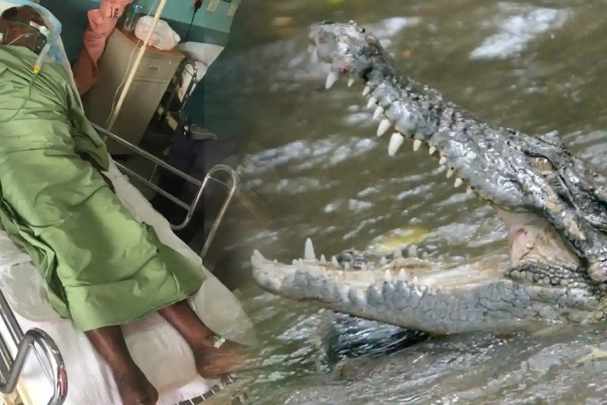 Pria Ini Naik Motor dalam Kondisi Terluka Karena Diterkam Buaya, Sampai di Rumah Sakit Pingsan