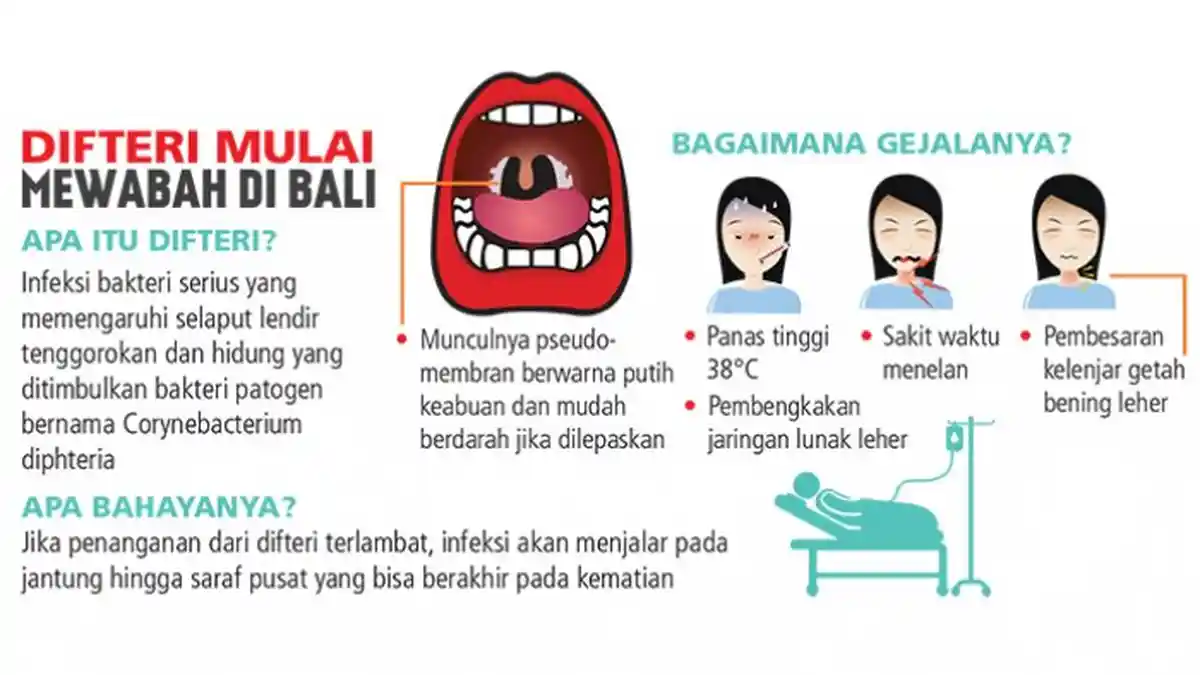Tiga Warga Bali Suspect Difteri Dirawat di RSUP Sanglah, Salah Satunya Wanita Hamil