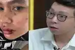 dokter-atau-dr-Richard-Lee-mengomentari-penyakit-yang-diderita-Kartika-Putri.jpg