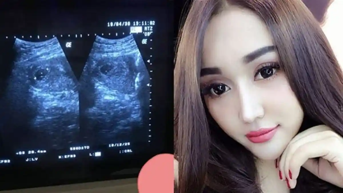 Rekan Lama Lucinta Luna Bocorkan Hal Mengejutkan Soal Isu Kehamilan, Sebut Sosok yang Menghamilinya