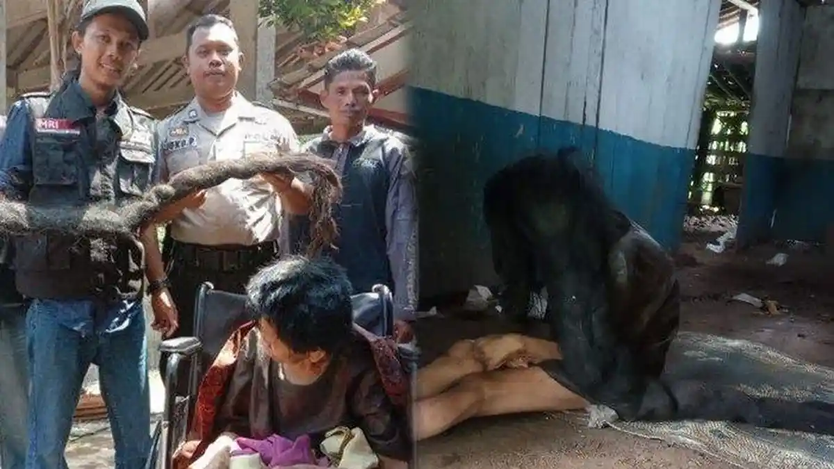 Setelah Viral, Begini Nasib Sukiyah Pemilik Rambut 2 Meter Jadi Sarang Tikus yang Hidup Seorang Diri