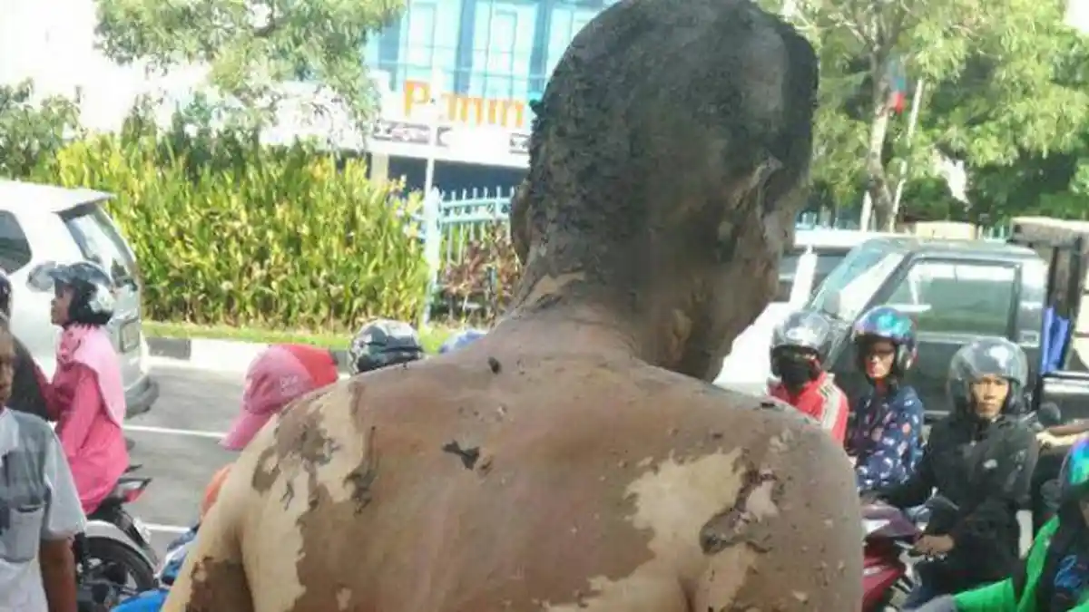 Edrian Dibakar Hidup-hidup Usai Dijemput 2 Orang, Katanya Gara-gara Utang Terkait Narkoba