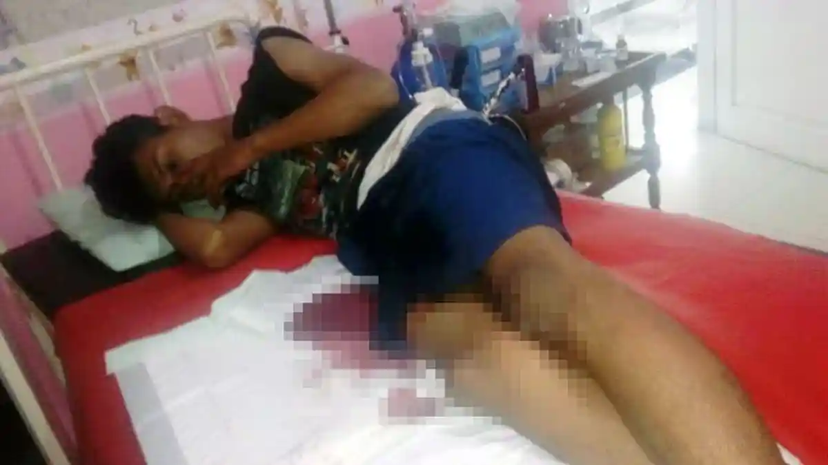 Pemuda Ini Dibacok Celurit Saat Berpapasan dengan Sekelompok Pelajar di Depok