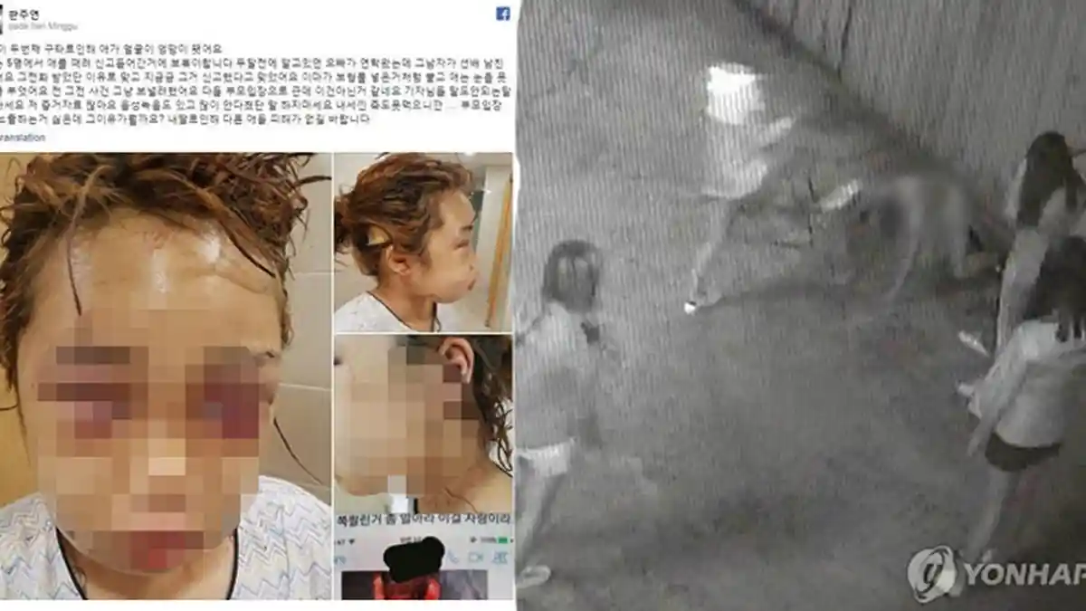 Gara-gara Cowok, Remaja Korea ini Dihajar Hingga Babak Belur Oleh Geng Seniornya