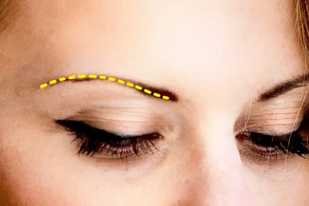 Ternyata Ini Alasannya Jerawat Sering Muncul di Alis, Tidak Cocok dengan Produk Alis