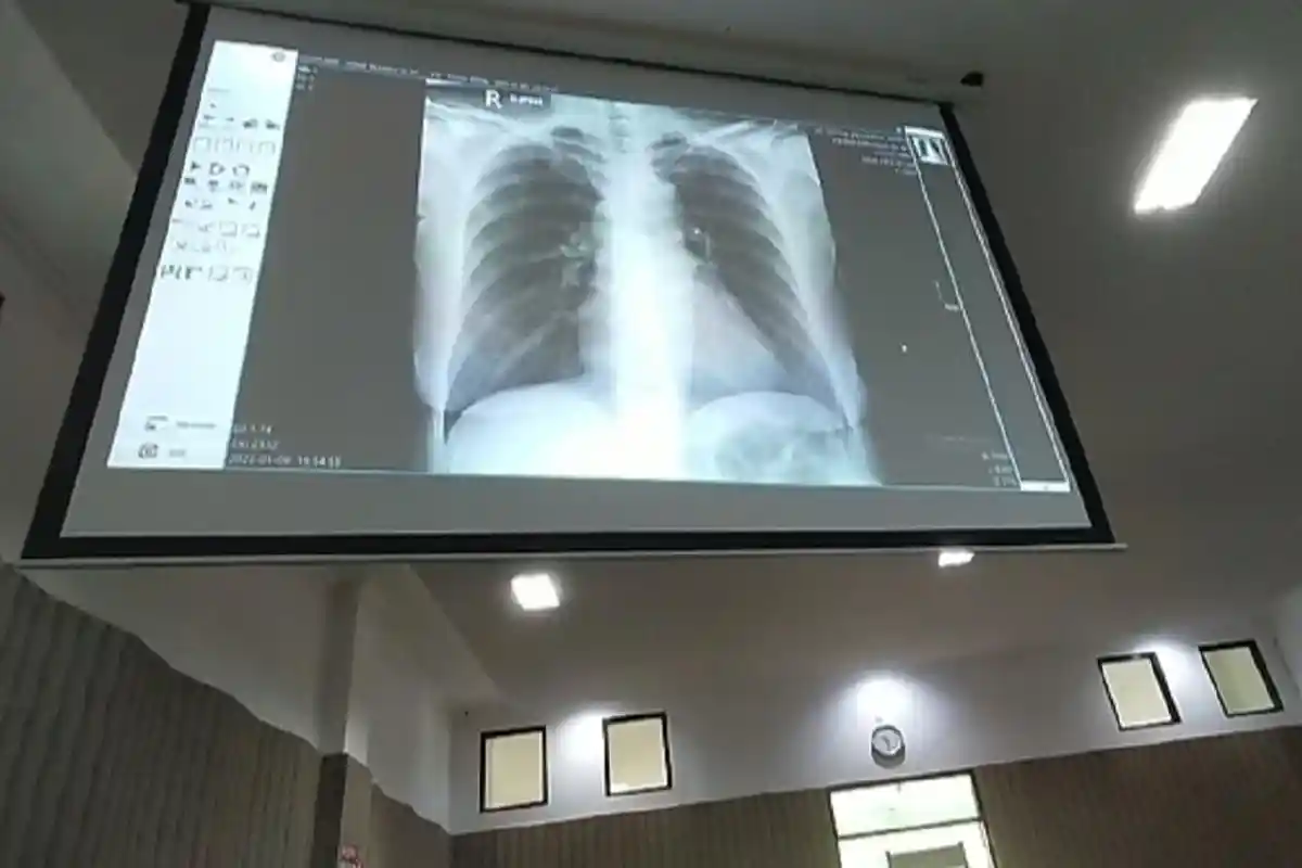 Penampakan Tulang Rusuk Venna Melinda yang Retak Ditampilkan di Persidangan Perkara KDRT