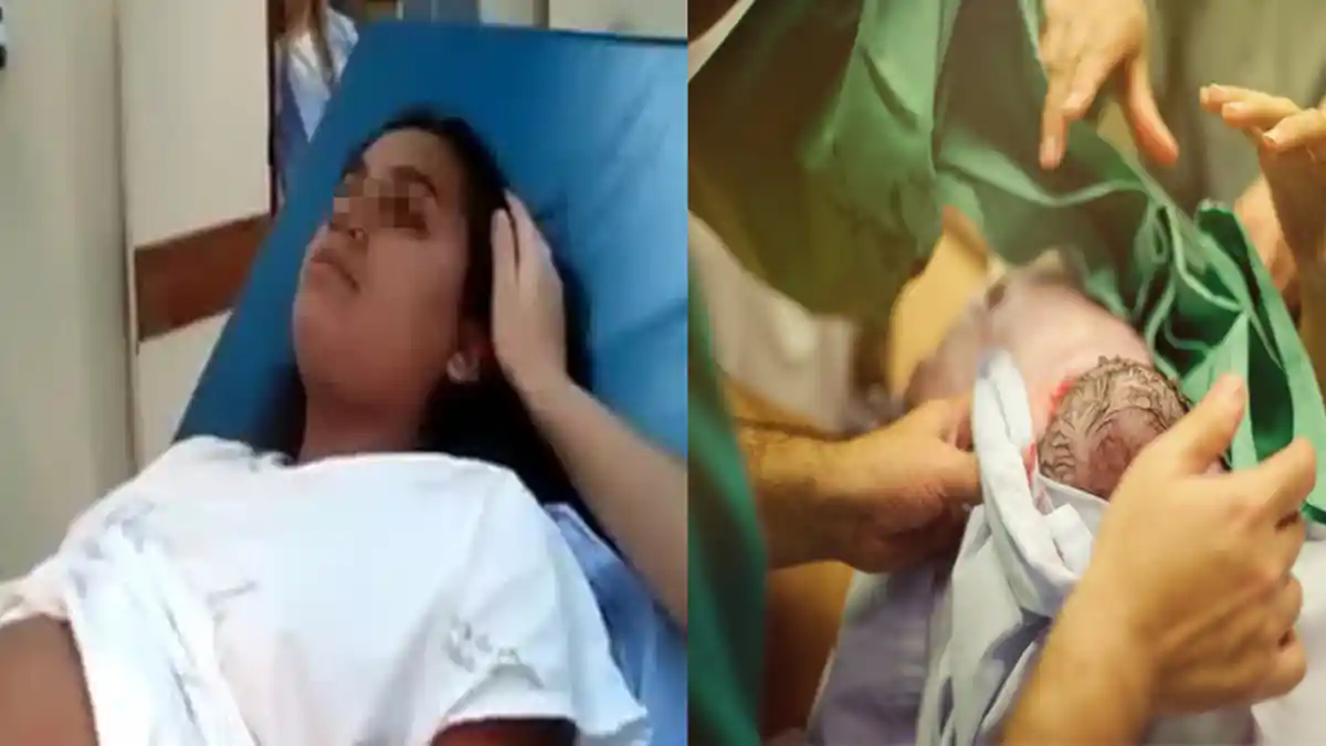 Sang Istri Melahirkan Anak Seperti 'Kelinci', Suami Tak Terima dan Minta Cerai