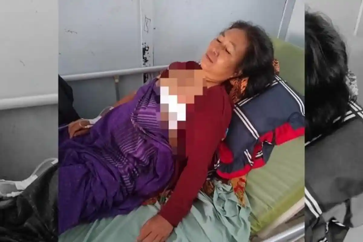 Penderita Kanker Payudara di Bengkulu Utara Butuh Uluran Tangan Dermawan