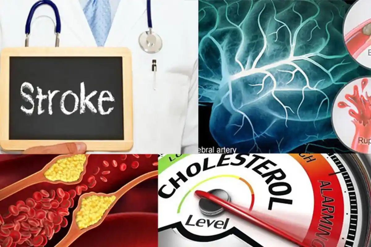 Cara Mencegah Stroke ! Lakukan 11 Tips Mencegah Stroke di Lingkungan Keluarga