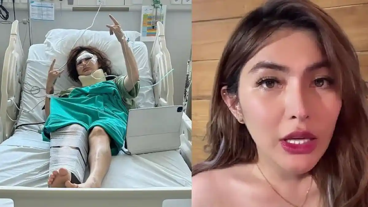 Efek Kecelakaan Lalu Lintas Pada Wajah Angela Lee, Diwarnai Lebam dan Jahitan