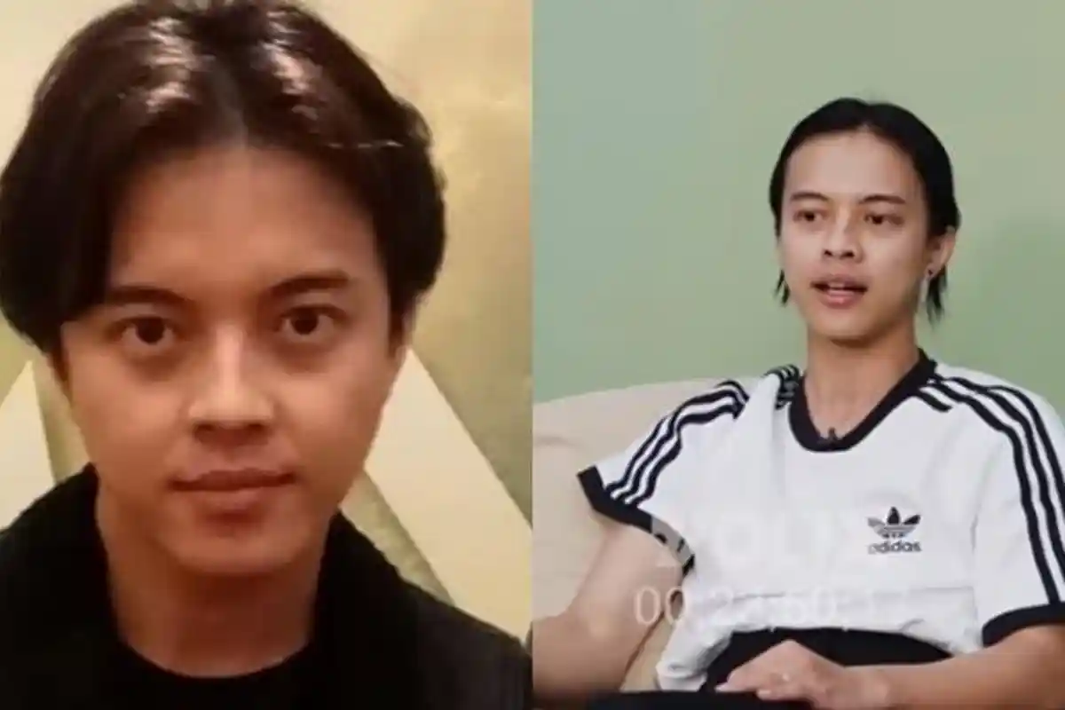 Curhat Bisma Smash Pernah Dibacok Anggota Geng Motor Sampai dapat 250 Jahitan, Jari Tangan Putus