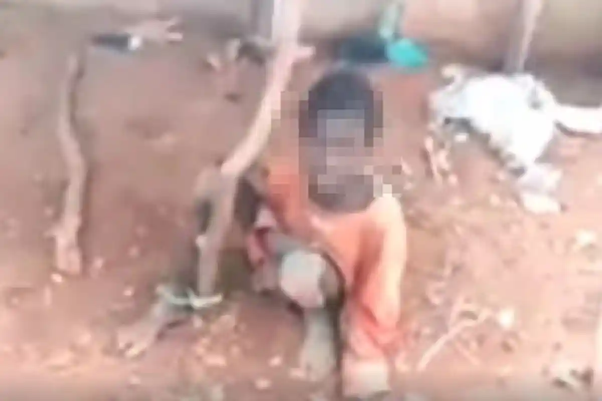 Jibril Berperilaku seperti Hewan Setelah Diikat Ibu Tiri di Pohon Selama 2 Tahun