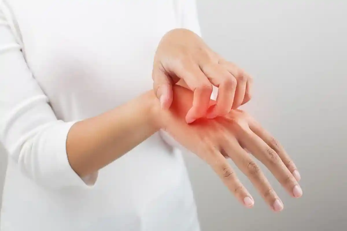 dr Zaidul Akbar Beberkan Bahan Herbal Obati Biduran, Selain Diminum juga Dibalurkan ke Area Tubuh