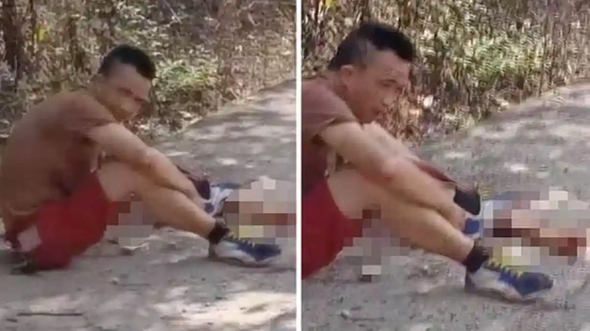 VIDEO Pria yang Duduk Tenang di Samping Lengannya yang Terputus, Ini Penyebabnya