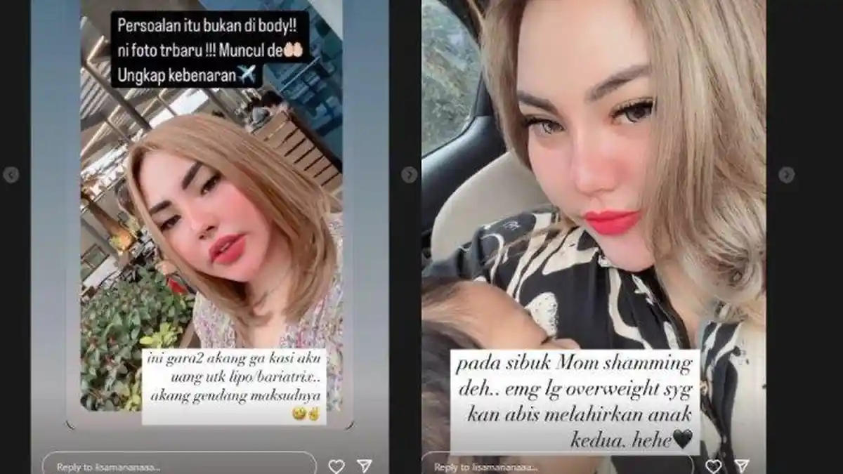 Kini Dapat Endorse Operasi Bariatrik di Malaysia, Lisa Mariana Optimis Kembali Langsing dan Cantik