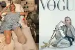 Kisah-Gadis-Cantik-Diamputasi-Gara-gara-Pembalut-Meski-Kehilangan-Kaki-Kini-Jadi-Model-Terkenal.jpg