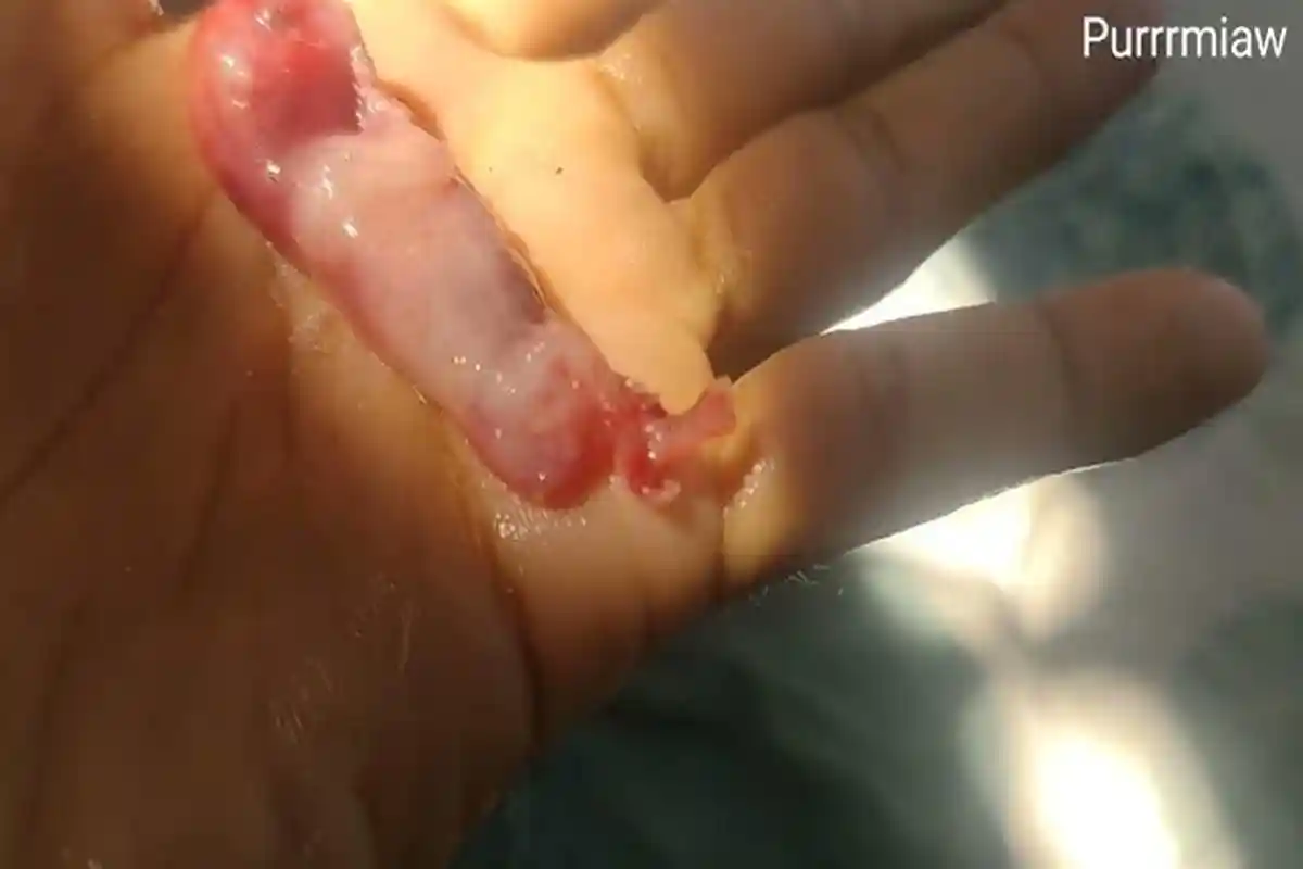 Geger Kucing Bawa Janin Perempuan Bersimbah Darah Dalam Kantong Plastik