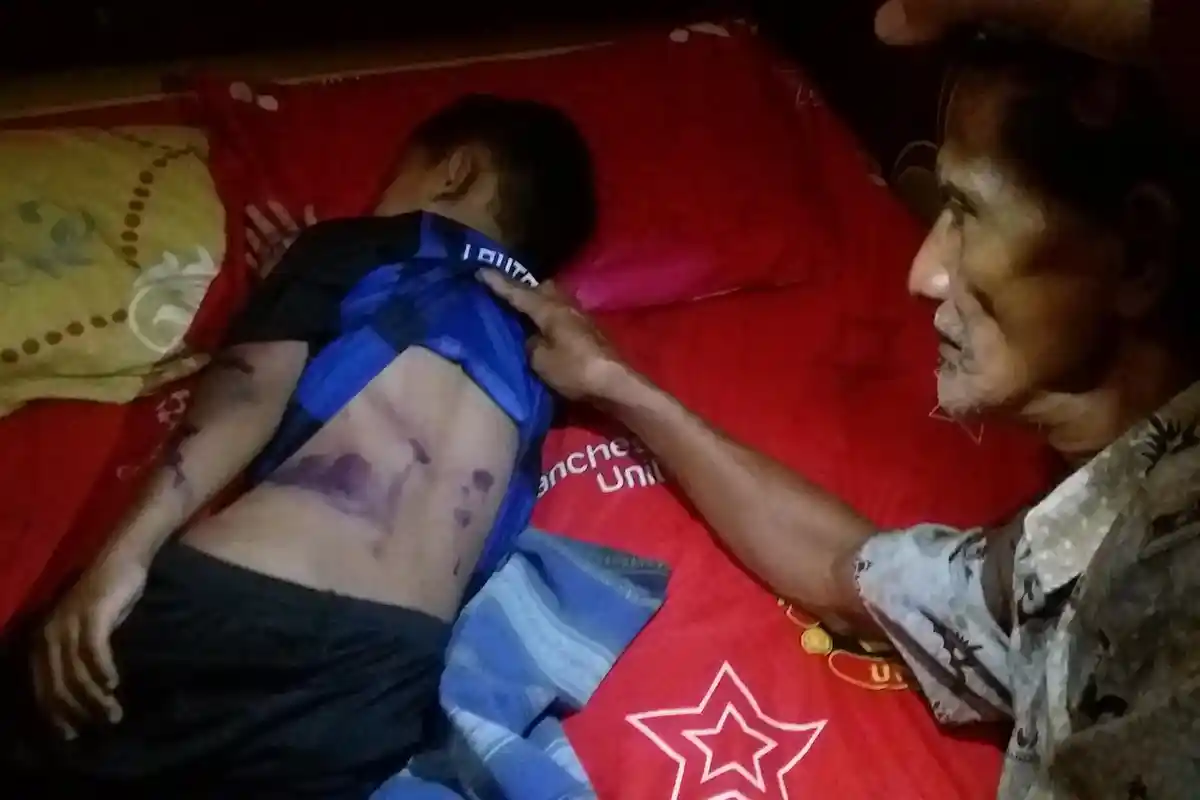 Diseret bak Kambing, Seorang Ayah di Pringsewu Tega Pukuli Anak Kandungnya Hingga Babak Belur