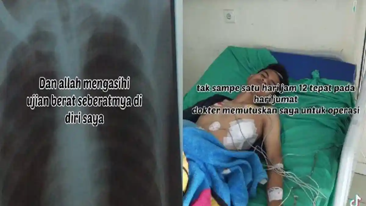 VIRAL Kisah Pemuda Kena Penyakit Ini Karena Merokok dan Begadang, Sempat Alami Kritis dan Koma