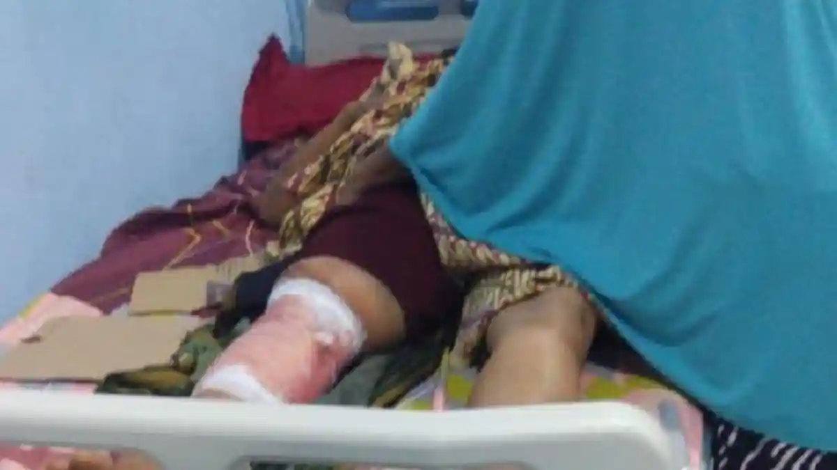 Warga Pidie Alami Luka di Betis Usai Diinjak Kaki Gajah