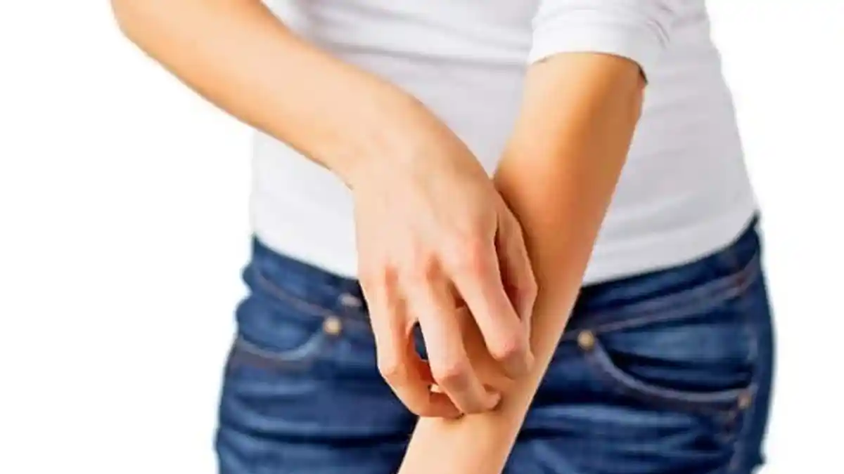 Cara Tepat Mengobati Penyakit Herpes yang Mengerikan dan Bikin Stres, Ikuti Petunjuknya