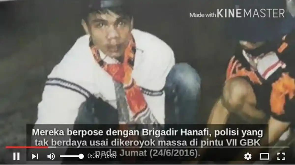 Mata Kiri Polisi Korban Penganiayaan Jakmania Harus Diangkat