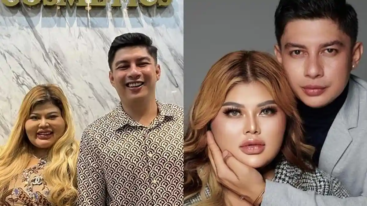 Masih Ingat Shindy dan Rendy Samuel? Seorang Aktor dan Bidan Banting Stir Jadi Pebisnis, Kini Sukses