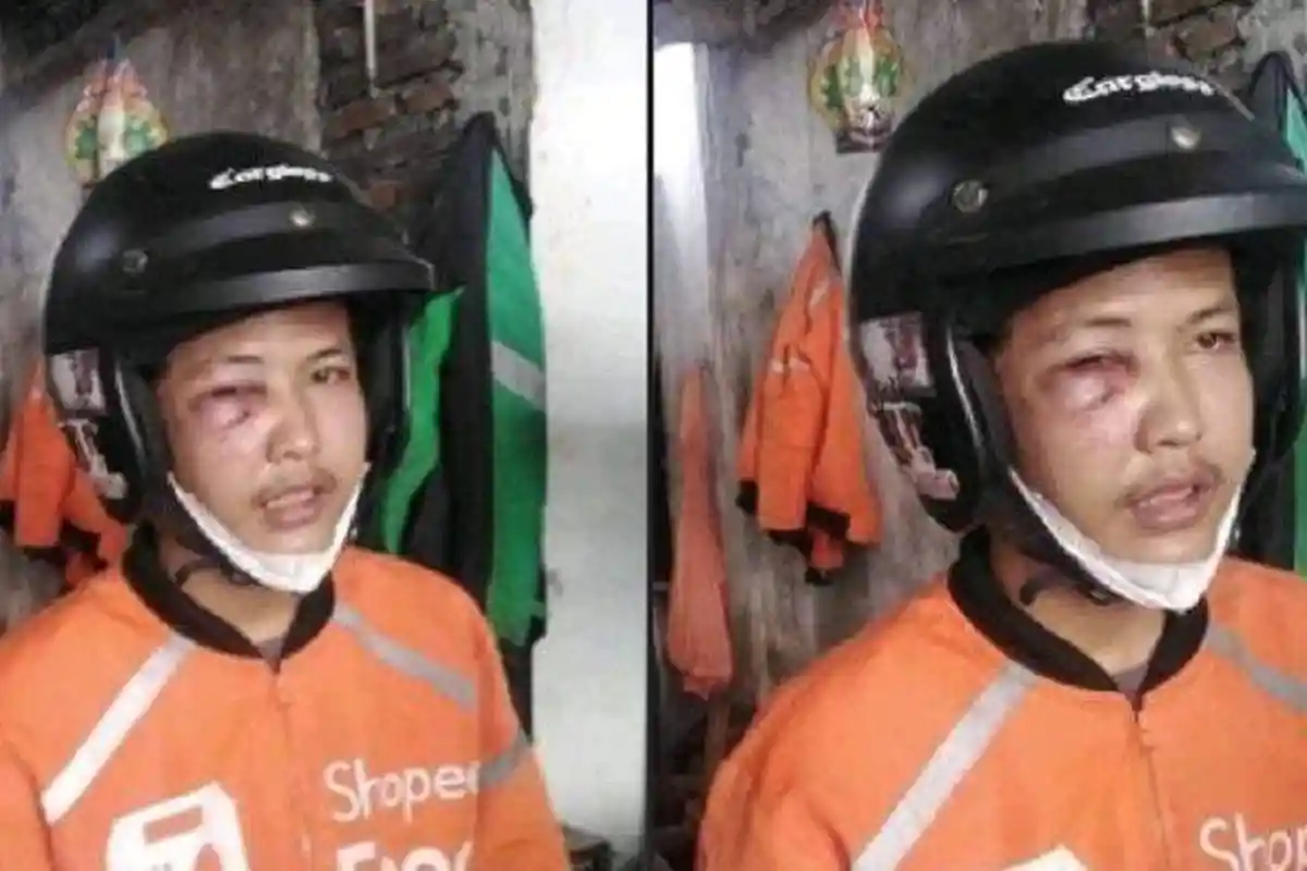 Bukan Dibegal, Driver Ojol yang Babak Belur Ternyata Mabuk dan Berkelahi, Berbohong karena Hal Ini