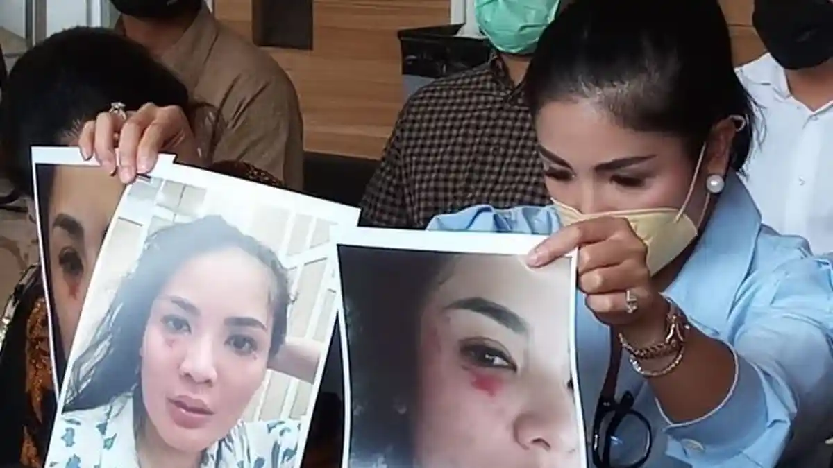 Memang Dapat Nafkah Rp 10 Juta tapi Nindy Ayunda Dilarang Lakukan Ini pada Askara