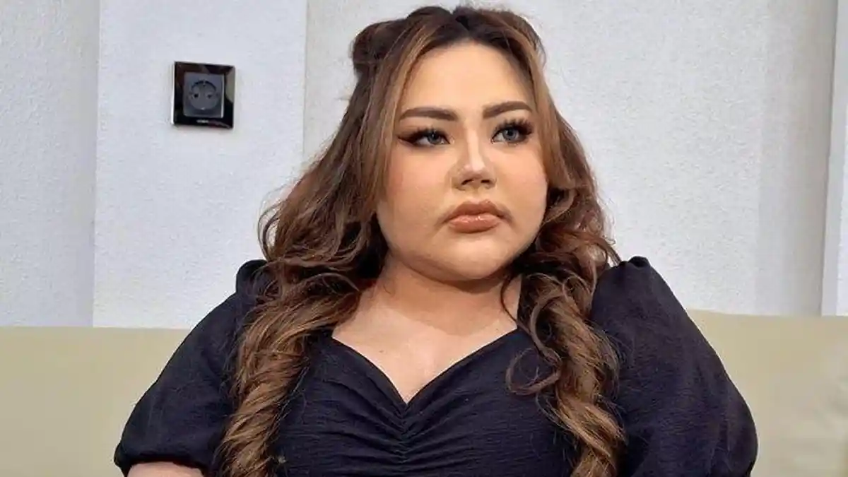 Curiga Hasil Tes DNA Direkayasa, Lisa Mariana Minta Ridwan Kamil Lakukan di 2 Tempat 'Gak main-main'