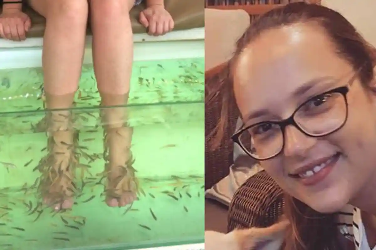 Gara-gara Ikut Terapi Rendam di Kolam Ikan, Wanita Ini Kehilangan Lima Jari Kakinya