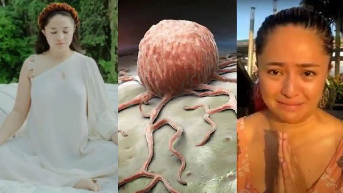 Sembuhkan Tumor, Marshanda Lakukan 3 Terapi Ini, Manjur Disertai Memanjatkan Doa Meminta Kesembuhan