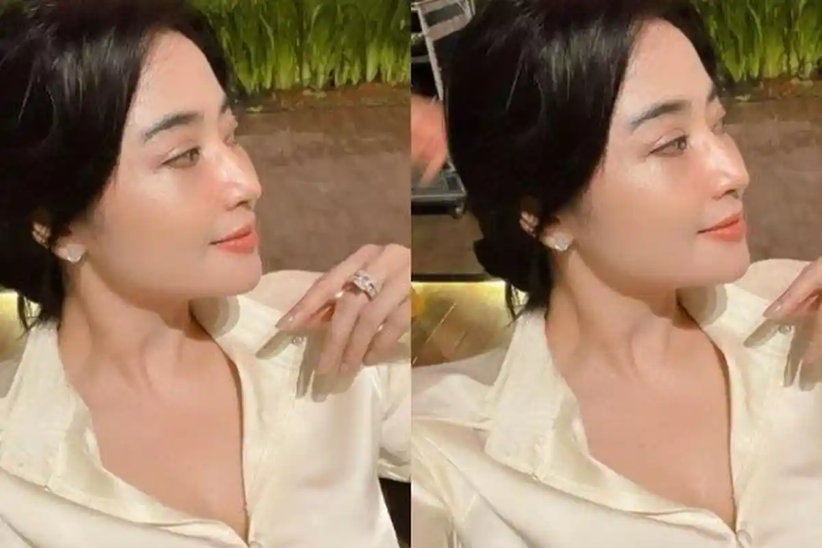 Takut Membusuk, Alasan Dewi Perssik Tolak Oplas Bagian Wajah Meski Dibayar Rp1 M, Ucap Amit-amit