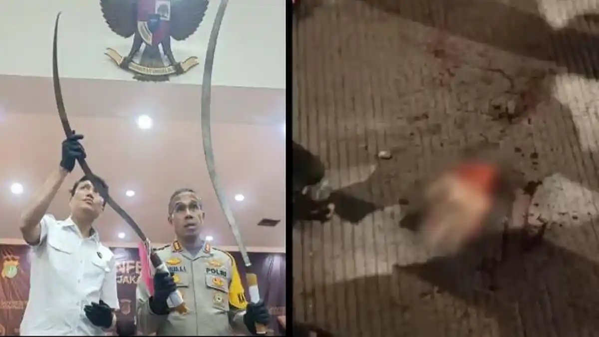 NASIB DSS, Anak Polisi Ikut Tawuran hingga Tangan Putus,Kini Nyesal Tangisi Cita-citanya Jadi Polisi