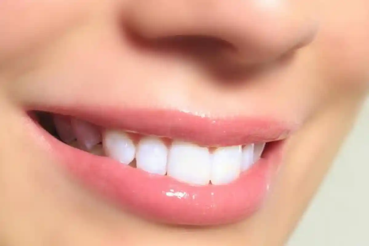 Cara Menggunakan BPJS Kesehatan untuk Tambal Gigi Berlubang, Simak Prosedurnya