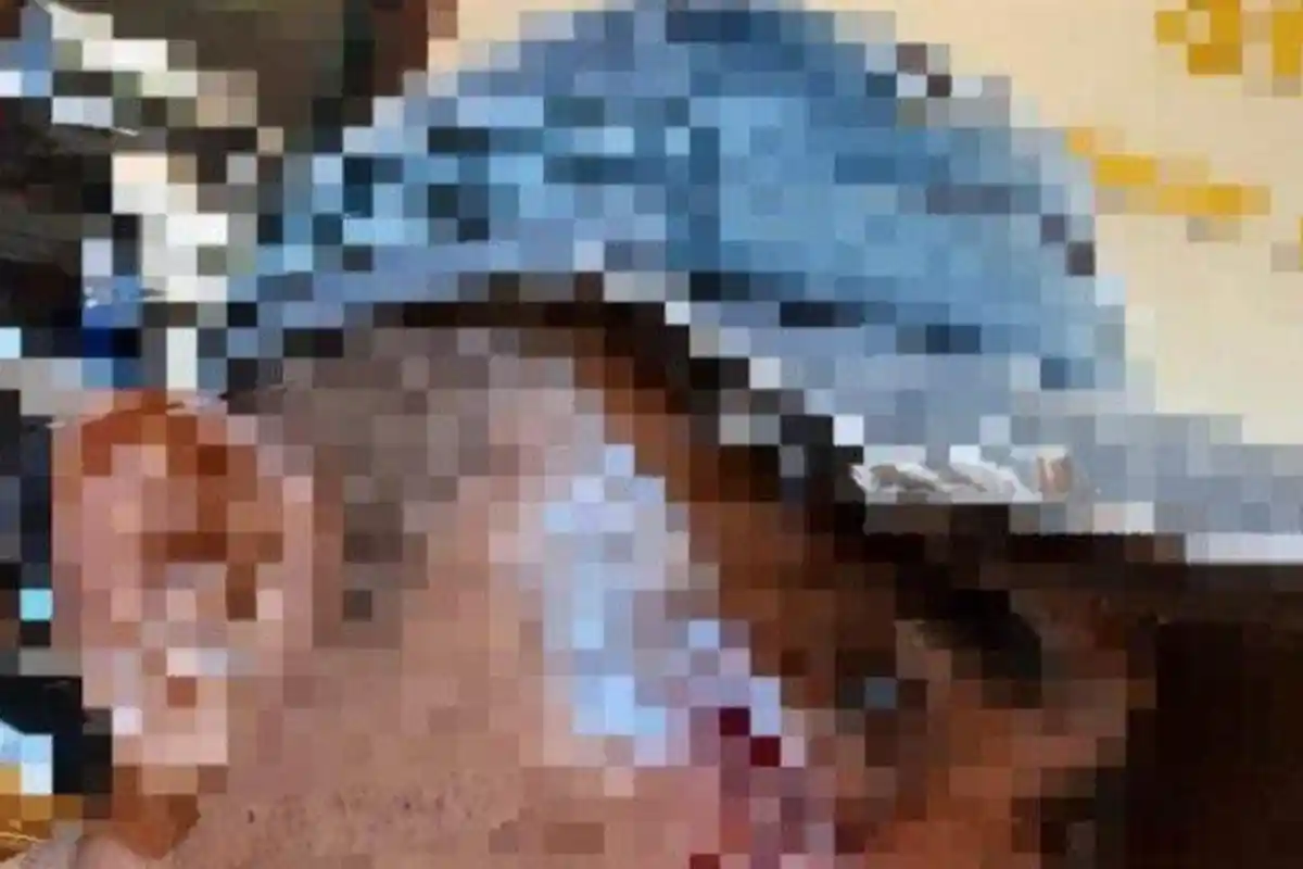 Dianiaya Anak Polisi di Flores Timur, Korban Duga Ada Unsur Rekayasa, Bakal Lapor ke Polda NTT