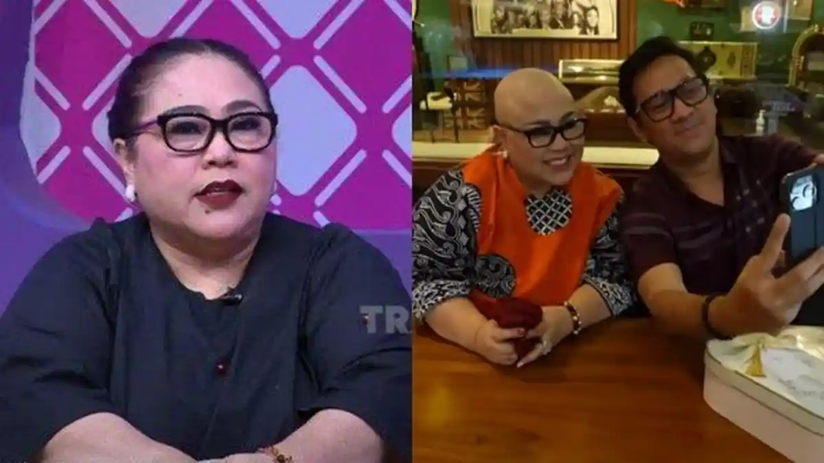 Kondisi Nunung Memprihatinkan Setelah Jalani Kemoterapi karena Penyakit Kanker