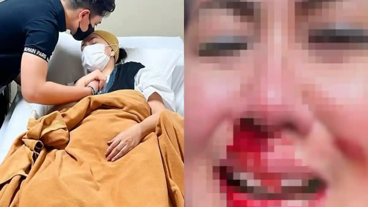 Pakai Skill Silat, Venna Melinda Akhirnya Bongkar Cara Brutal Ferry Irawan Menghajarnya