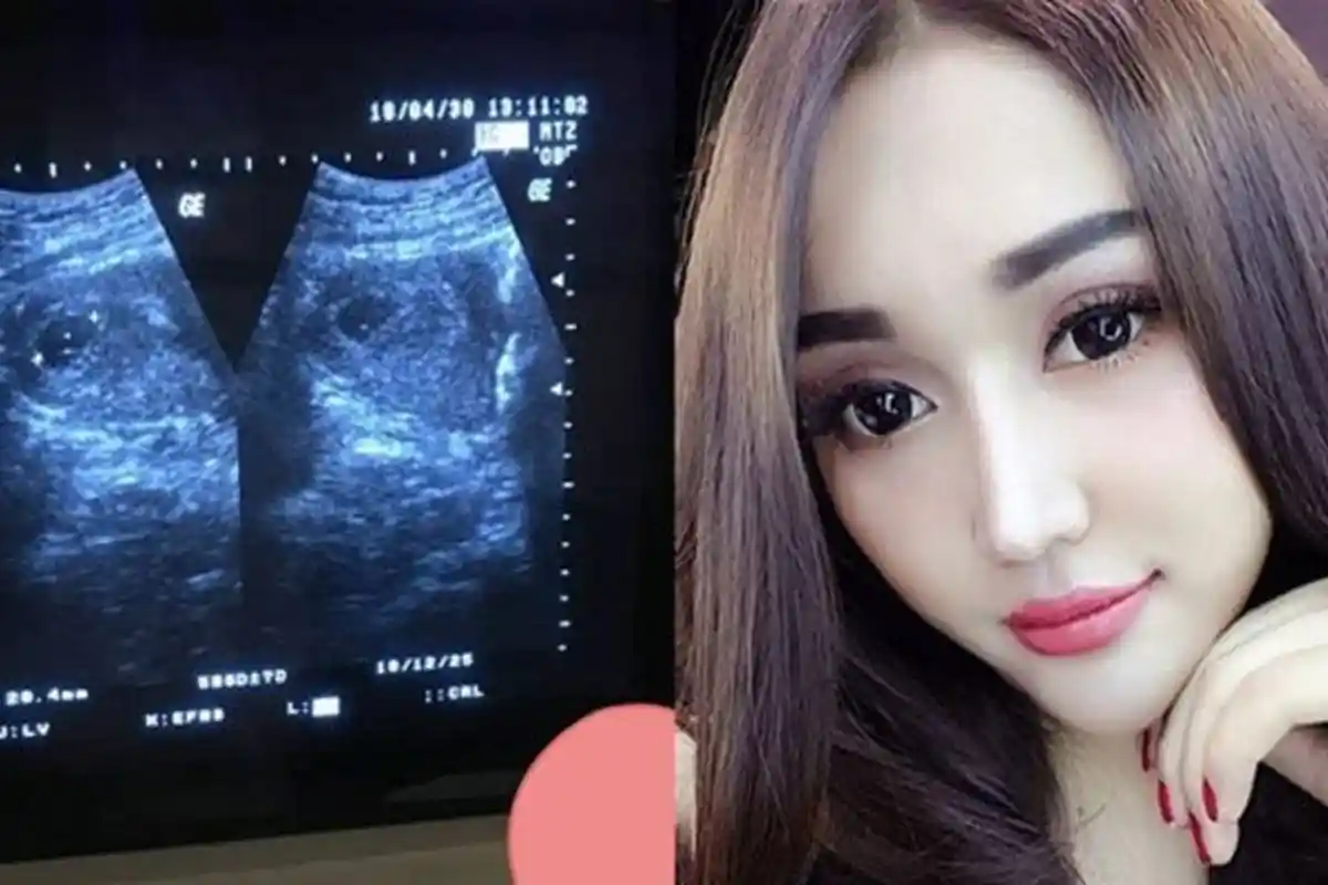 Heboh Lucinta Luna Hamil, Klarifikasi Tentang Test Pack-nya Bikin Netizen Mikir Keras