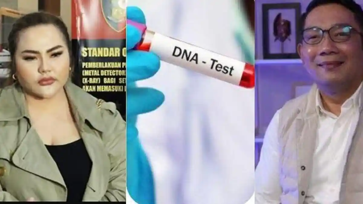 Tes DNA Jadi Babak Baru Kasus Ridwan Kamil Vs Lisa Mariana, Begini Proses Pemeriksaannya